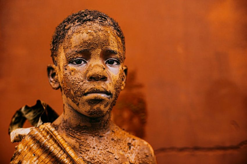 深入了解 Rejuran水光針：提升肌膚質感的秘密武器